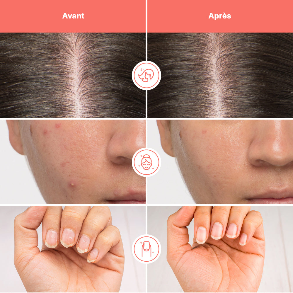 Beauté Pure - Complément Alimentaire