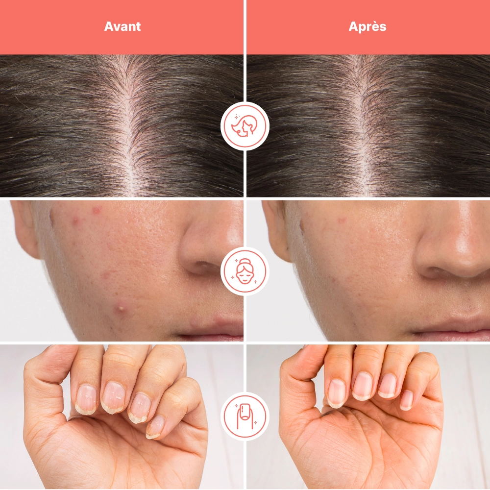 Beauté Pure - Complément Alimentaire