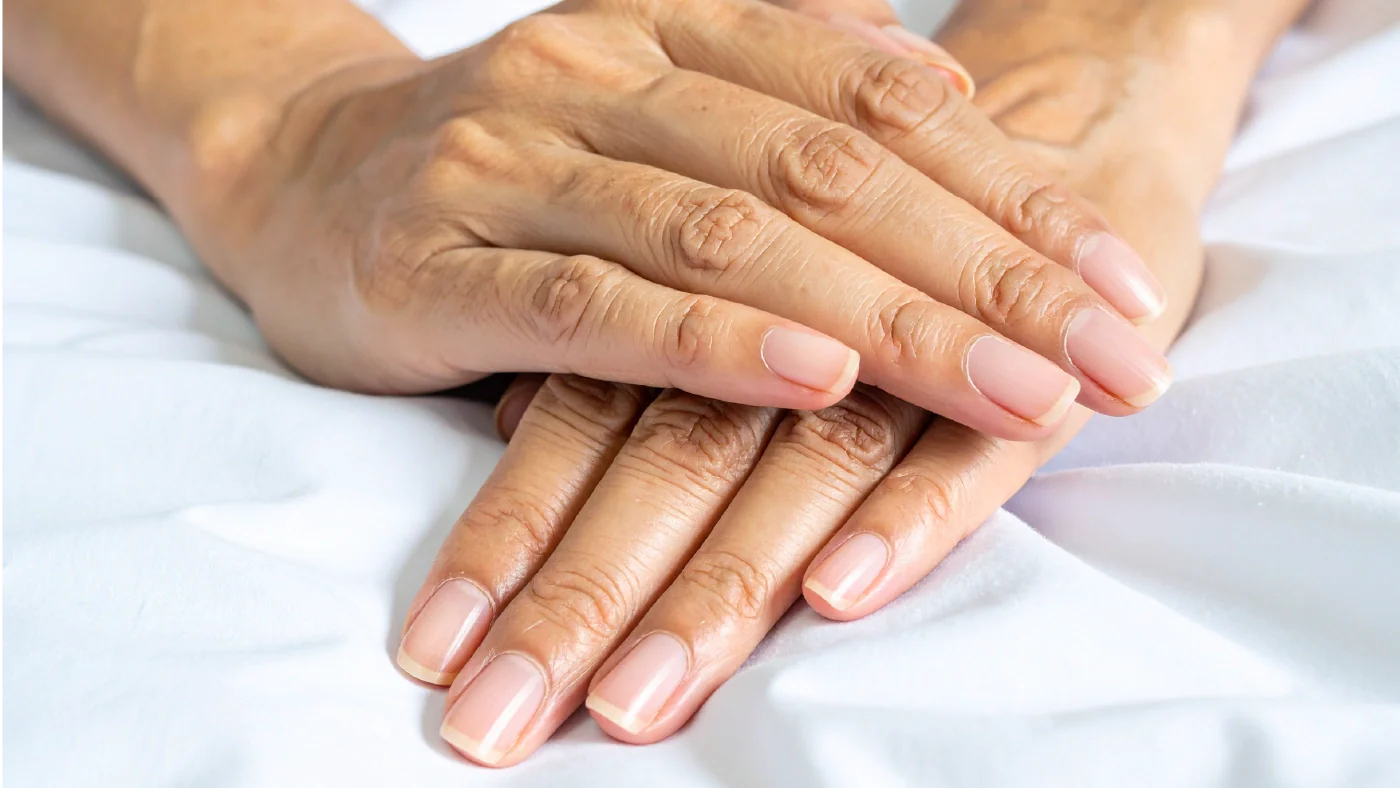 Pourquoi vos ongles se cassent ? Les causes et les solutions naturelles.